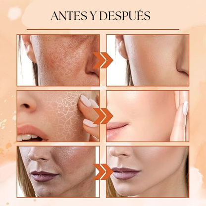 Loción Facial 5 en 1 con Vitamina C+ Activa – 130 ml | SADOER