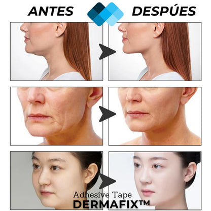 Tiras de lifting facial con efecto natural (PACK DE 40 UNIDADES)