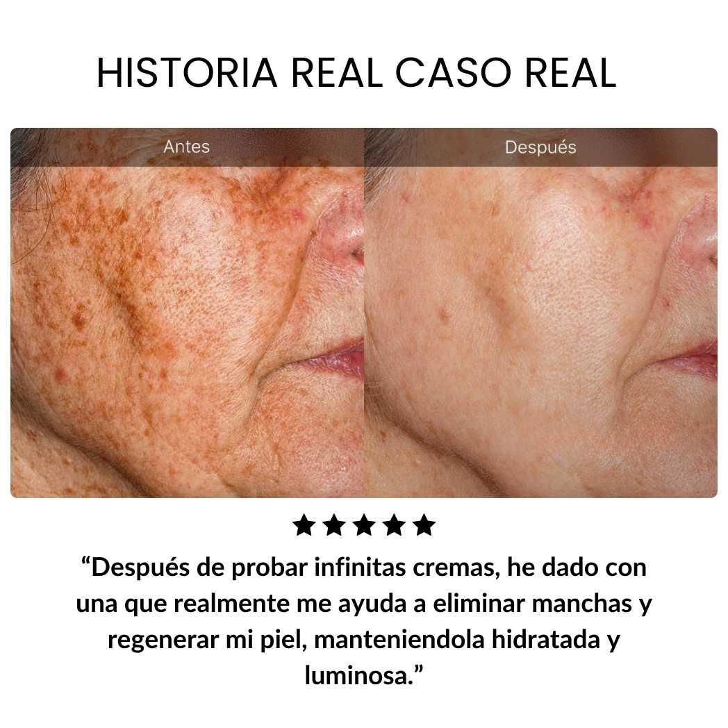 Crema AntiEdad Sangre de Dragón – Reafirma la Piel y Suaviza Arrugas