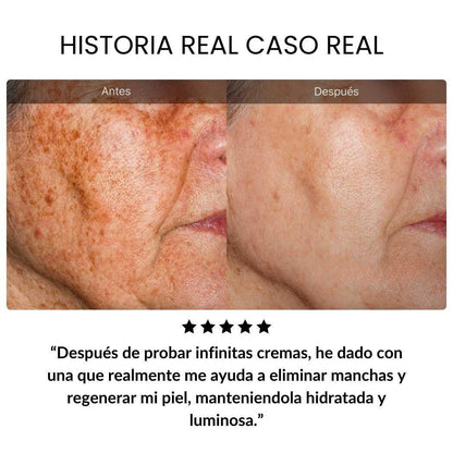 Crema AntiEdad Sangre de Dragón – Reafirma la Piel y Suaviza Arrugas
