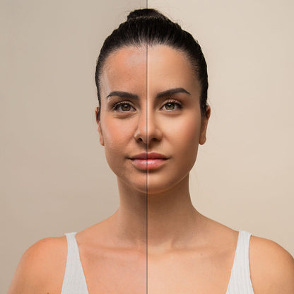Masajeador facial eléctrico para rostro y cuello con LED, EMS y calor Selora